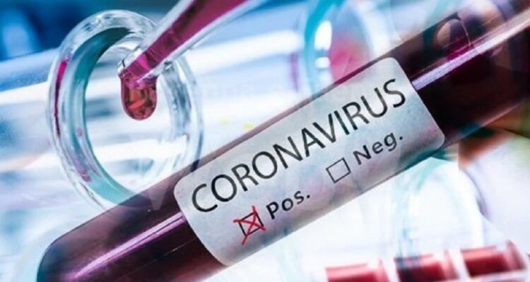 Coronavirus-medico-positivo-al-test-ha-fatto-3-turni-allospedale-di-Treviso-e-in-isolamento-750x400-1