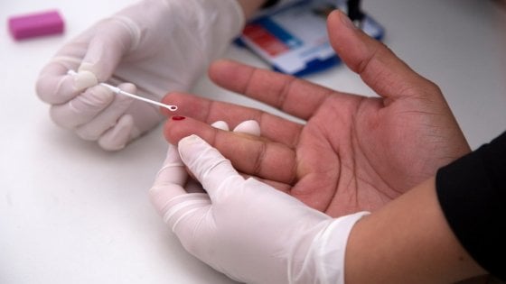 hiv